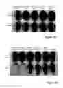 Fig. 16 - Liposomes co-encapsulating a bisphosphonate and an amphipathic agent