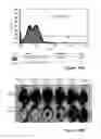 Fig. 17 - Liposomes co-encapsulating a bisphosphonate and an amphipathic agent
