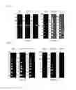 Fig. 02 - Methods of administering interferon gamma to absorb fluid from the subretinal space