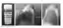 Fig. 01 - METHOD FOR PREPARING BIOCOMPATIBLE SMALL INTESTINAL MUCOSA HYDROGEL CAPABLE OF CONTROLLING IN-VIVO DEGRADATION PERIOD