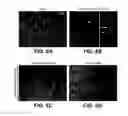 Fig. 07 - MODULATION OF AXON DEGENERATION