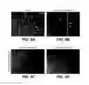 Fig. 09 - MODULATION OF AXON DEGENERATION
