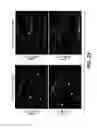 Fig. 22 - MODULATION OF AXON DEGENERATION