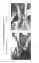 Fig. 06 - ELECTROCHEMICALLY GENERATED ANTIMICROBIAL SODIUM HYDROXIDE SOLUTION