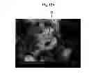 Fig. 14 - Secondary structure of carbon nanostructure, bundle thereof and composite comprising same