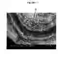 Fig. 17 - Secondary structure of carbon nanostructure, bundle thereof and composite comprising same