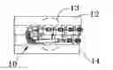Fig. 01 - Orthodontic appliance for bite correction