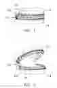 Fig. 02 - Orthodontic appliance for bite correction