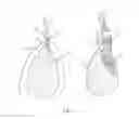 Fig. 02 - System and method for a bone engaging dental implant surgical stent placement system
