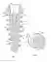 Fig. 04 - Self-osteotomizing bone implant and related method