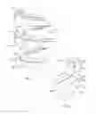 Fig. 05 - Self-osteotomizing bone implant and related method