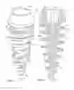 Fig. 06 - Self-osteotomizing bone implant and related method