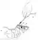 Fig. 01 - METHOD FOR SEATING A DENTAL RESTORATION