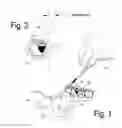 Fig. 02 - METHOD FOR SEATING A DENTAL RESTORATION