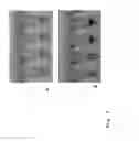 Fig. 02 - Method for detecting the synthesis and/or amplification of a target nucleic acid sequence