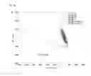 Fig. 04 - MEANS AND METHODS FOR ASSESSING SPERM NUCLEAR DNA STRUCTURE