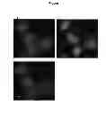 Fig. 02 - METHOD FOR CHARACTERIZING CIRCULATING TUMOR CELLS, AND USE THEREOF IN DIAGNOSIS