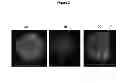 Fig. 03 - METHOD FOR CHARACTERIZING CIRCULATING TUMOR CELLS, AND USE THEREOF IN DIAGNOSIS