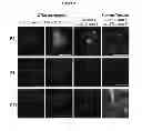 Fig. 04 - METHOD FOR CHARACTERIZING CIRCULATING TUMOR CELLS, AND USE THEREOF IN DIAGNOSIS