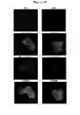 Fig. 06 - METHOD FOR CHARACTERIZING CIRCULATING TUMOR CELLS, AND USE THEREOF IN DIAGNOSIS
