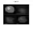 Fig. 08 - METHOD FOR CHARACTERIZING CIRCULATING TUMOR CELLS, AND USE THEREOF IN DIAGNOSIS