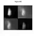 Fig. 09 - METHOD FOR CHARACTERIZING CIRCULATING TUMOR CELLS, AND USE THEREOF IN DIAGNOSIS