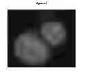 Fig. 10 - METHOD FOR CHARACTERIZING CIRCULATING TUMOR CELLS, AND USE THEREOF IN DIAGNOSIS