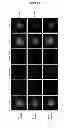 Fig. 13 - METHOD FOR CHARACTERIZING CIRCULATING TUMOR CELLS, AND USE THEREOF IN DIAGNOSIS