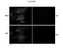 Fig. 14 - METHOD FOR CHARACTERIZING CIRCULATING TUMOR CELLS, AND USE THEREOF IN DIAGNOSIS