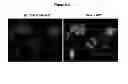Fig. 16 - METHOD FOR CHARACTERIZING CIRCULATING TUMOR CELLS, AND USE THEREOF IN DIAGNOSIS
