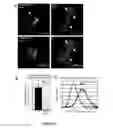 Fig. 06 - METHODS AND KITS FOR DIAGNOSING AND/OR PROGNOSING OSTEOARTHRITIS