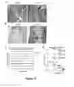 Fig. 16 - METHODS AND KITS FOR DIAGNOSING AND/OR PROGNOSING OSTEOARTHRITIS