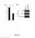 Fig. 17 - METHODS AND KITS FOR DIAGNOSING AND/OR PROGNOSING OSTEOARTHRITIS