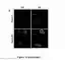 Fig. 23 - METHODS AND KITS FOR DIAGNOSING AND/OR PROGNOSING OSTEOARTHRITIS