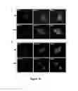 Fig. 25 - METHODS AND KITS FOR DIAGNOSING AND/OR PROGNOSING OSTEOARTHRITIS