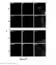 Fig. 26 - METHODS AND KITS FOR DIAGNOSING AND/OR PROGNOSING OSTEOARTHRITIS