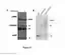 Fig. 30 - METHODS AND KITS FOR DIAGNOSING AND/OR PROGNOSING OSTEOARTHRITIS