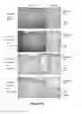 Fig. 32 - METHODS AND KITS FOR DIAGNOSING AND/OR PROGNOSING OSTEOARTHRITIS