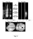 Fig. 11 - Media comprising a glutamine biosensor and methods of use thereof