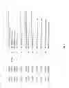 Fig. 22 - Compositions and methods for lipid production