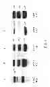 Fig. 10 - EXPRESSION IN INSECT CELLS OF GENES WITH OVERLAPPING OPEN READING FRAMES, METHODS AND COMPOSITIONS THEREFOR
