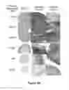 Fig. 03 - TISSUE REPAIR WITH MULTIPOTENT CELLS