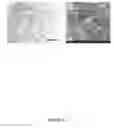 Fig. 14 - THREE-DIMENSIONAL NANOSTRUCTURED HYBRID SCAFFOLD AND MANUFACTURE THEREOF