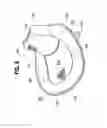 Fig. 08 - Collapsible flotation device