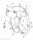 Fig. 19 - Collapsible flotation device