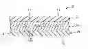 Fig. 01 - GLITTER FILM BACKING FOR ADHESIVE TAPES AND METHODS OF MAKING THE SAME