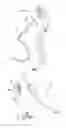 Fig. 02 - Toy figure with movable appendage