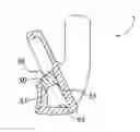 Fig. 01 - Golf club head with undercut