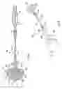 Fig. 04 - Streamer ball