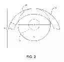 Fig. 03 - Planetary gear assembly